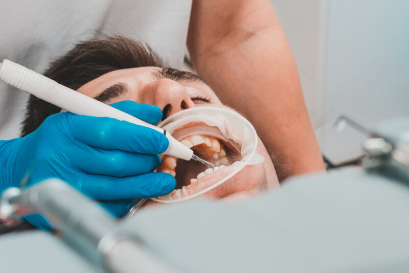 Dental Cleanings Waterloo
